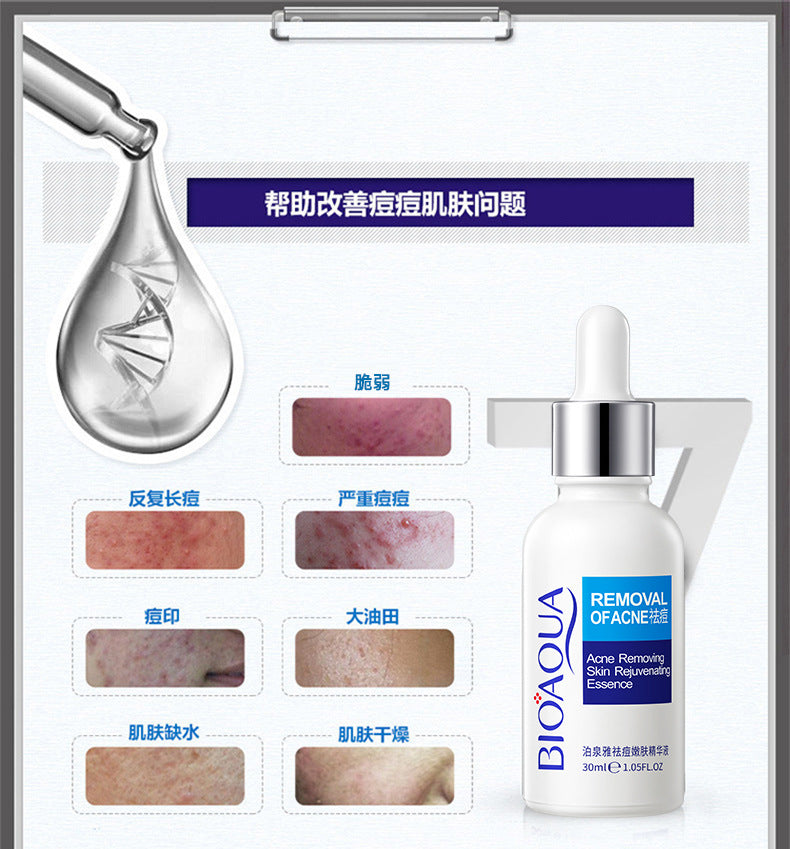Bioaqua Pure Skin & Removal Acne & Anti Acne Serum Facial Removal Solution
