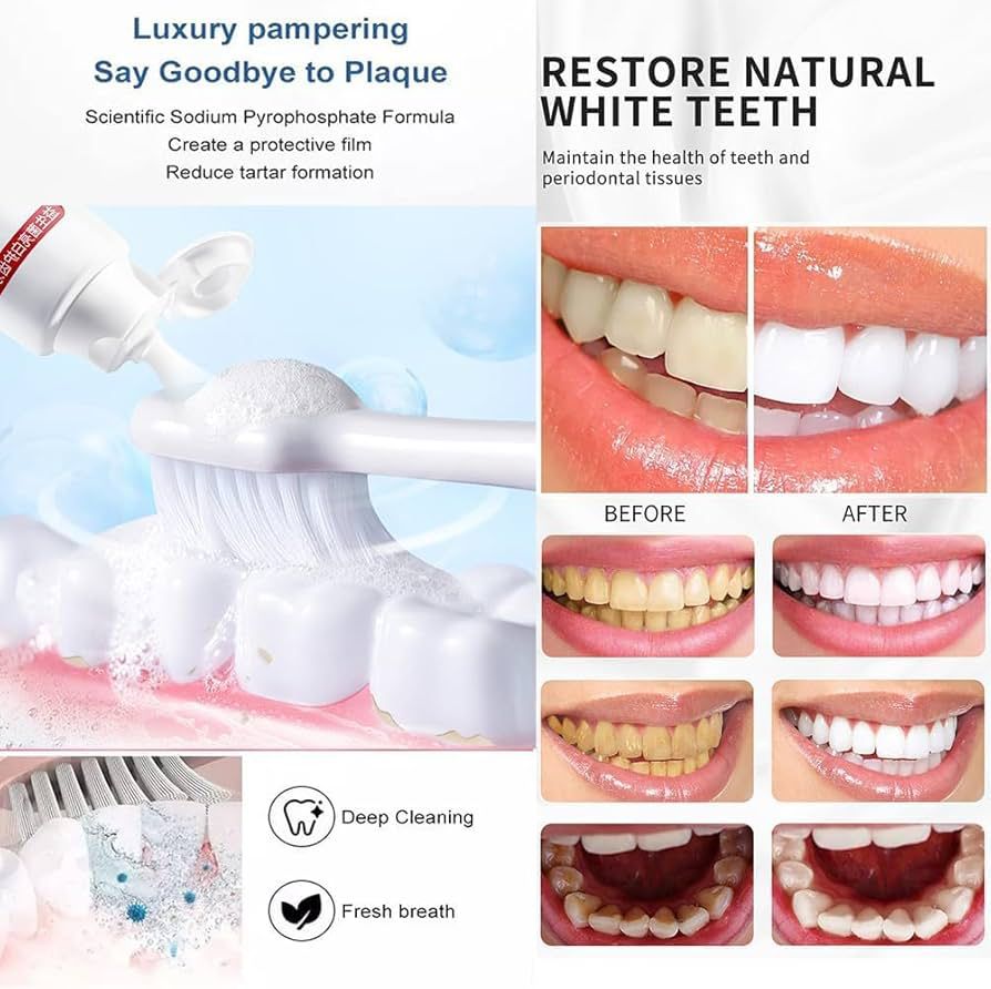 SP-4 Whitening Toothpaste