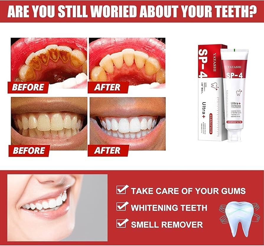 SP-4 Whitening Toothpaste